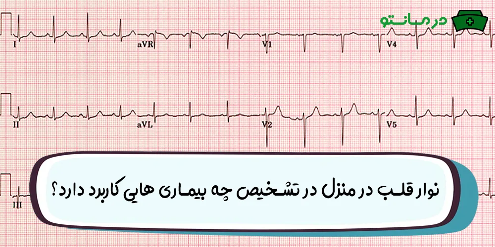 نوار قلب در منزل تهران (هزینه جدید سال 1405 + شبانه روزی)