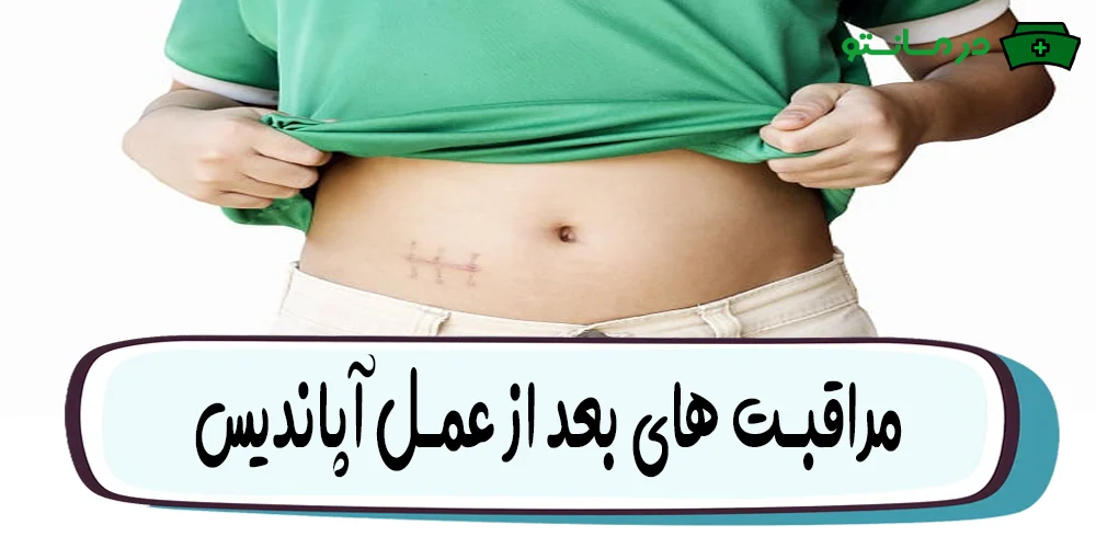 مراقبت های بعد از عمل آپاندیس