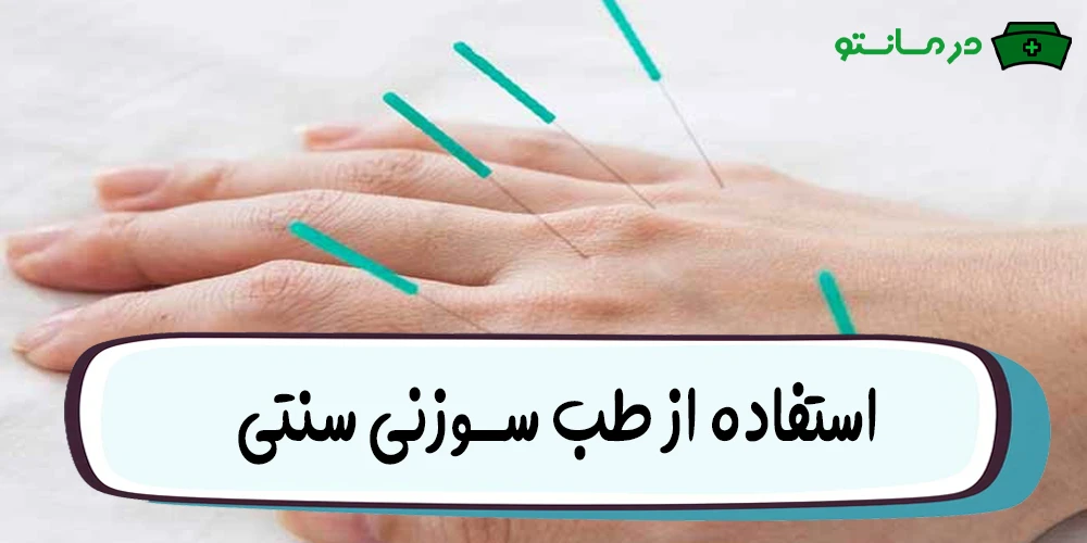 استفاده از طب سوزنی سنتی