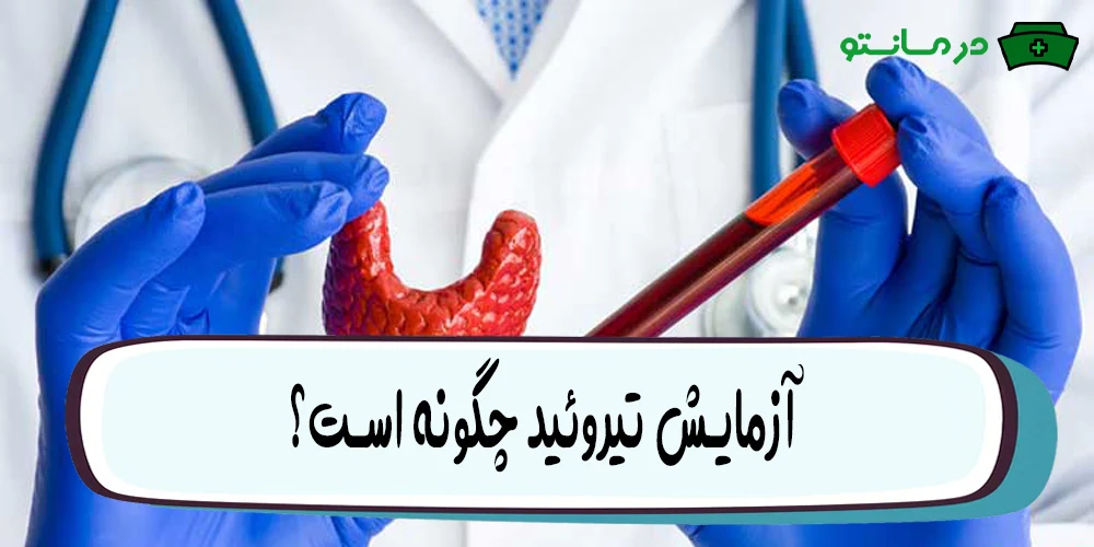 آزمایش تیروئید چگونه است؟