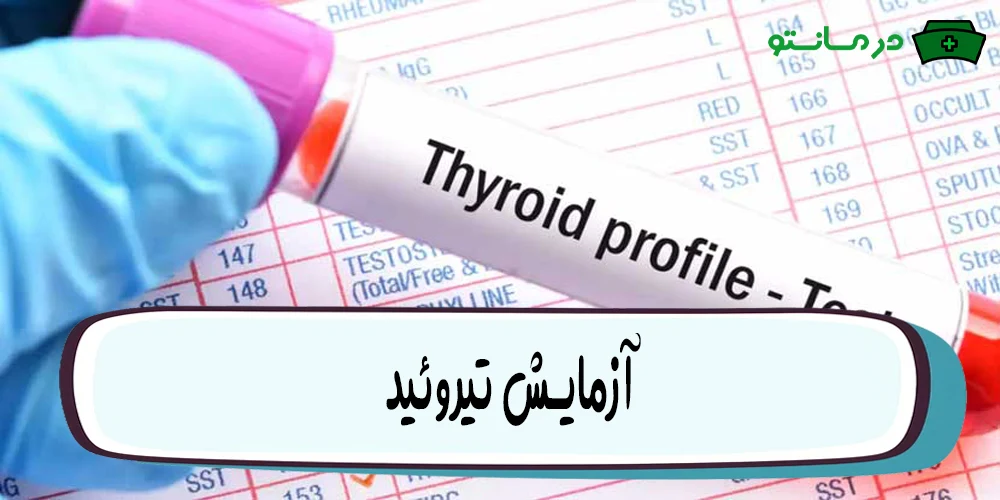 آزمایش تیروئید
