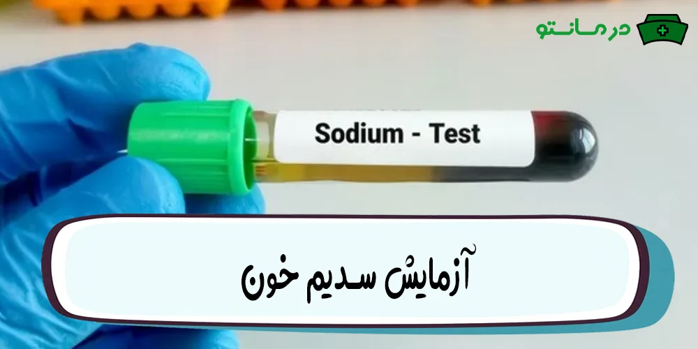 آزمایش سدیم