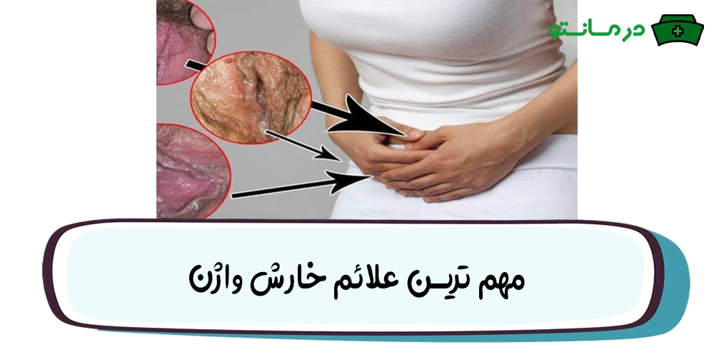 مهم ترین علائم خارش واژن به چه صورتی ظاهر می گردد؟