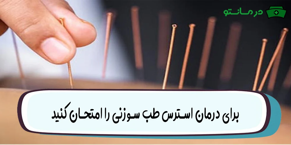 برای درمان استرس طب سوزنی را امتحان کنید