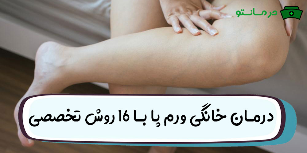 درمان خانگی ورم پا با 16 روش تخصصی