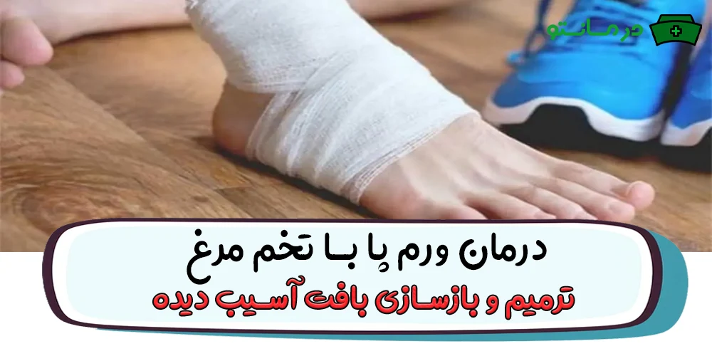 درمان ورم پا با تخم مرغ