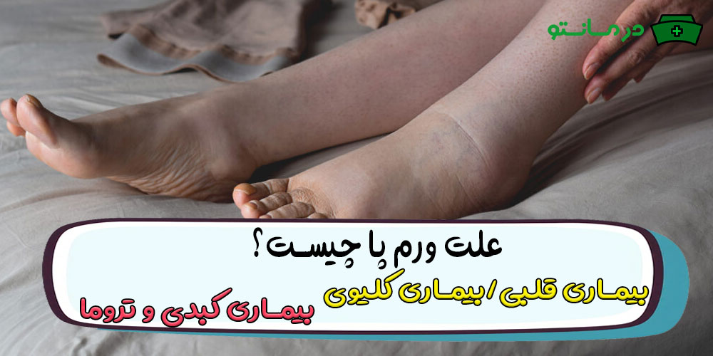 علت ورم پا چیست؟ (ورم پا نشانه چیست؟)