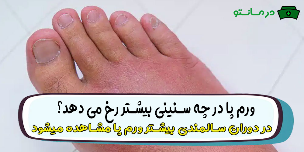 ورم پا در چه سنینی بیشتر رخ می دهد؟