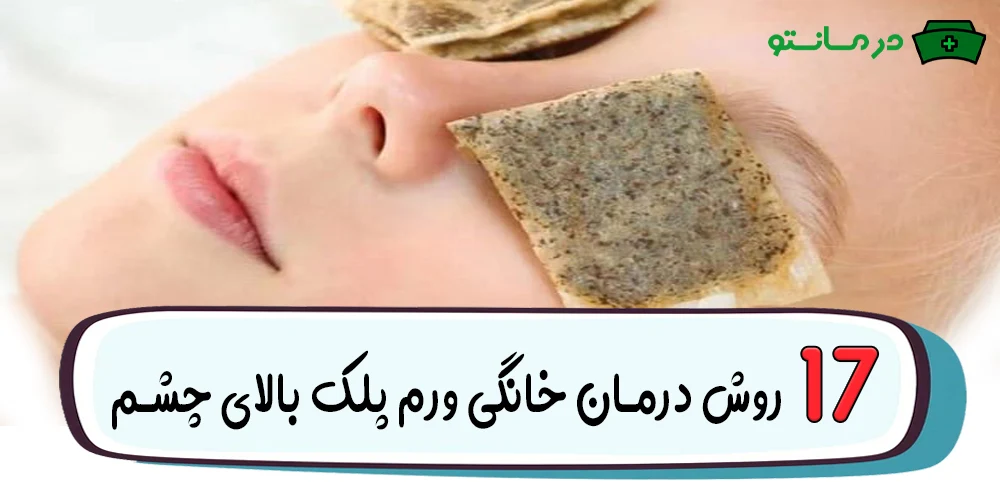 17 روش درمان خانگی ورم پلک بالای چشم (درمان خانگی پف بالای چشم)