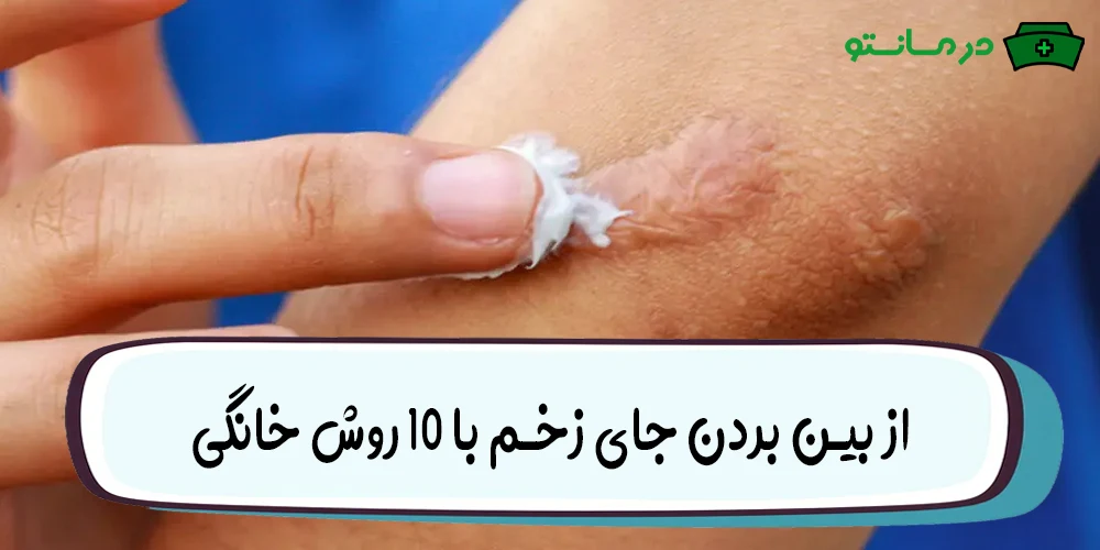 از بین بردن جای زخم