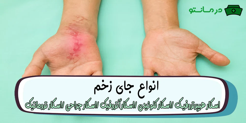 جای زخم به طورکلی به چند نوع قابل مشاهده است؟