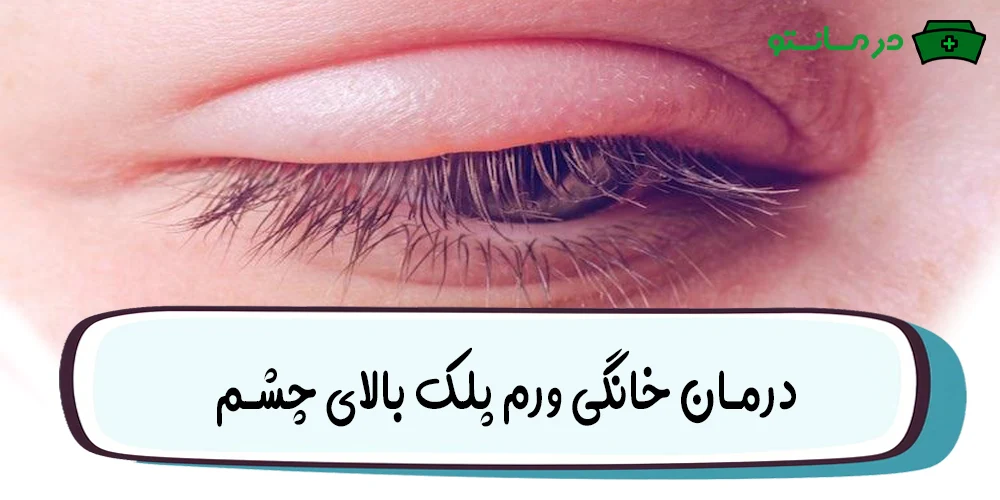 درمان خانگی ورم پلک بالای چشم