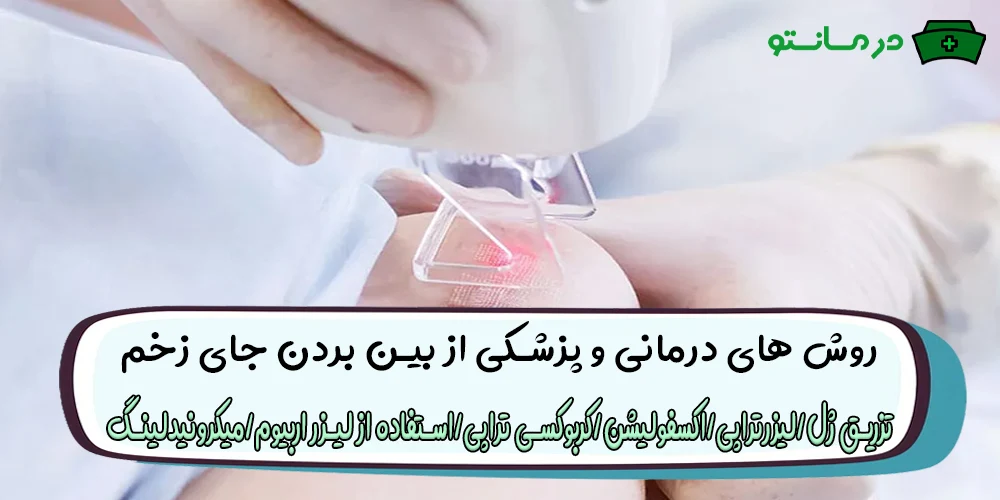 روش های درمانی و پزشکی از بین بردن جای زخم