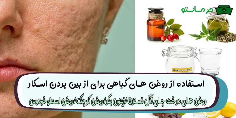 استفاده از روغن های گیاهی