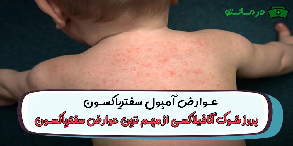 عوارض آمپول سفتریاکسون چیست؟