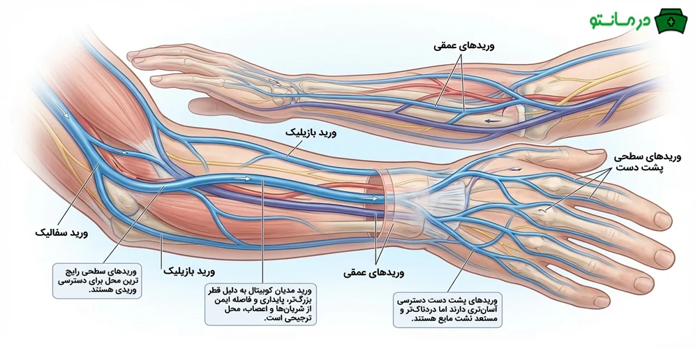 آناتومی رگ های دست برای رگ گیری