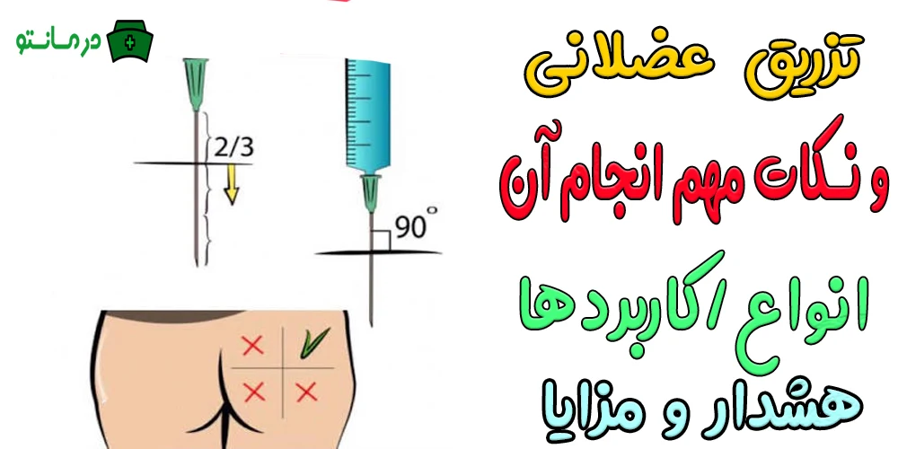 تزریق عضلانی