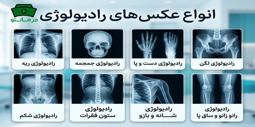 تصاویر حاصل از رادیولوژی در منزل شمال تهران کدامند؟