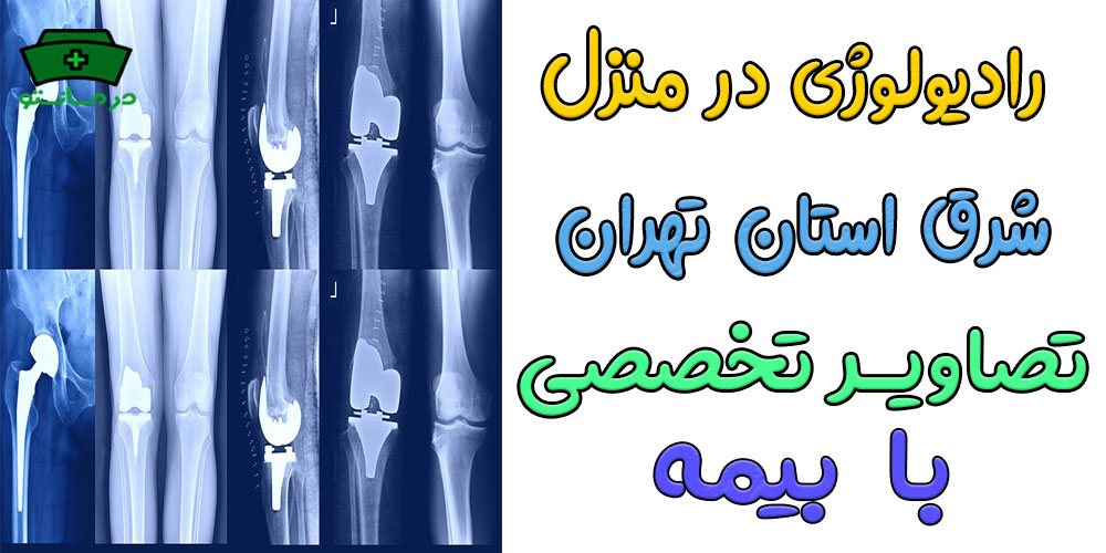 رادیولوژی در منزل شرق تهران