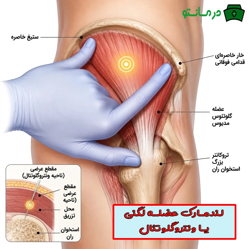 تزریق عضلانی ونتروگلوتئال