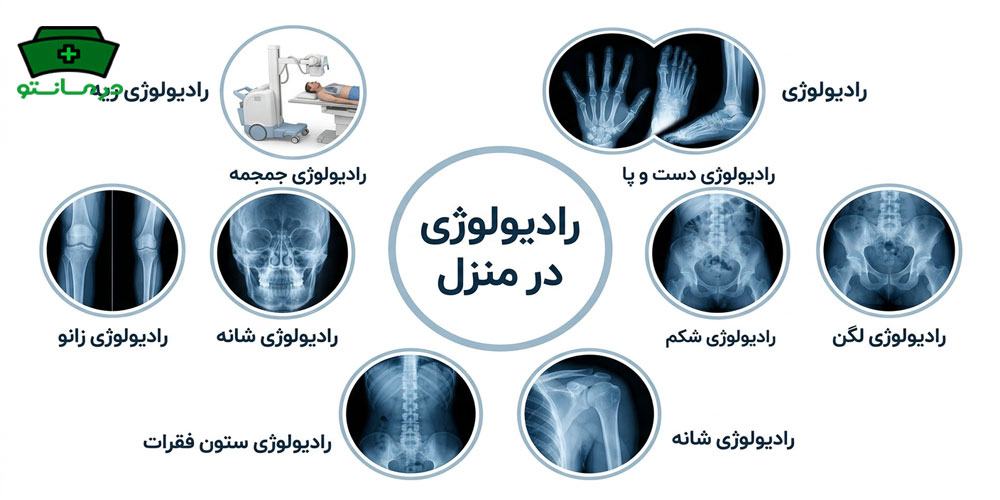 چند تصویر از انجام خدمات رادیولوژی در منزل جنوب تهران انتظار میرود؟