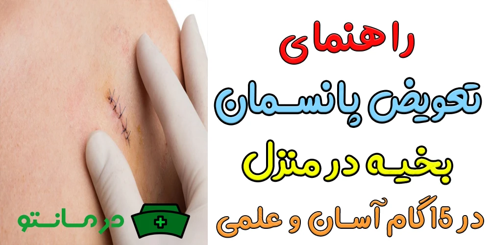 راهنمای تعویض پانسمان بخیه در منزل