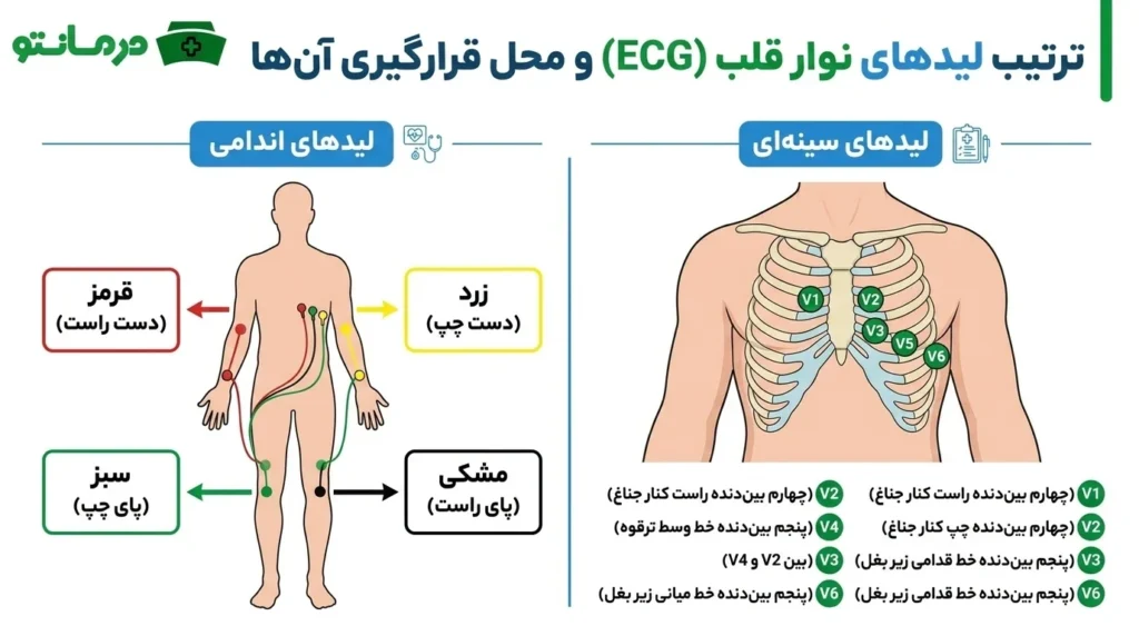 ترتیب لیدهای نوار قلب به چه صورتی است؟ (محل لیدهای نوار قلب)