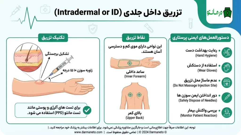تزریق داخل جلدی (Intradermal or ID)