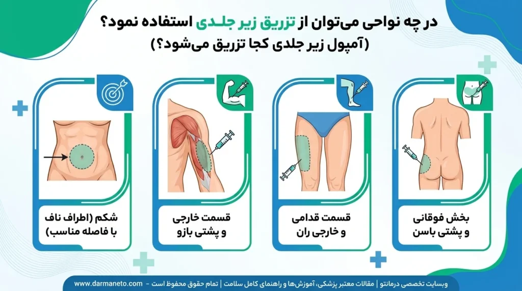 در چه نواحی می توان از تزریق زیر جلدی استفاده نمود؟ (آمپول زیر جلدی کجا تزریق میشود؟)