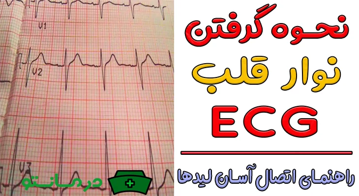 نحوه گرفتن نوار قلب ECG