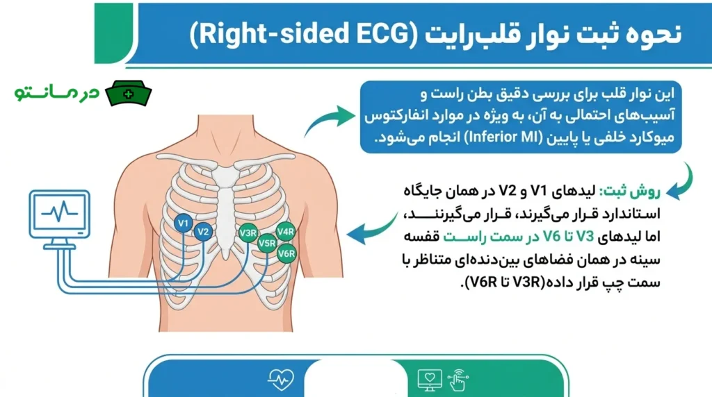 نحوه-گرفتن-نوار-قلب-رایت-نمای-راست