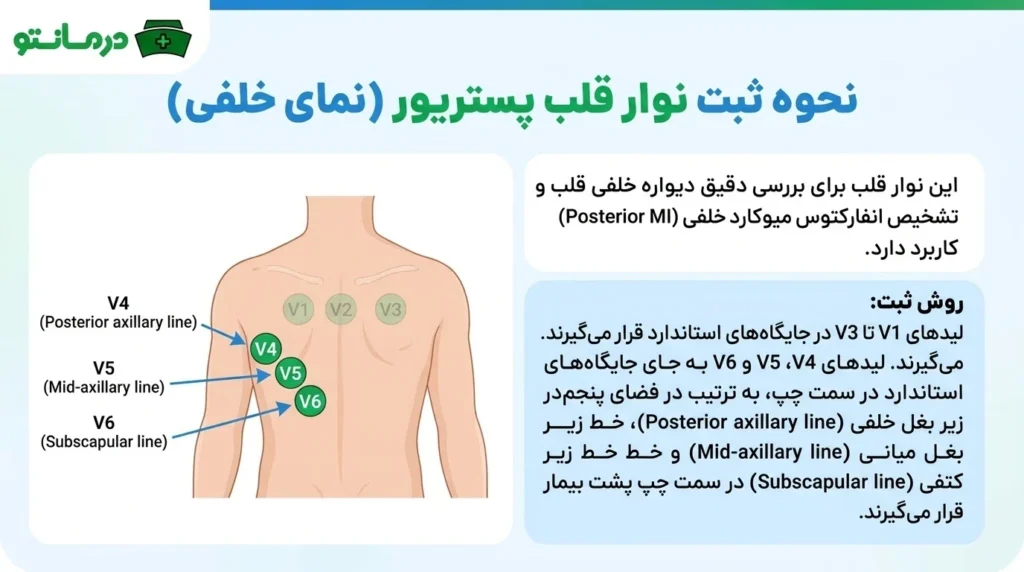 نحوه گرفتن نوار قلب پست