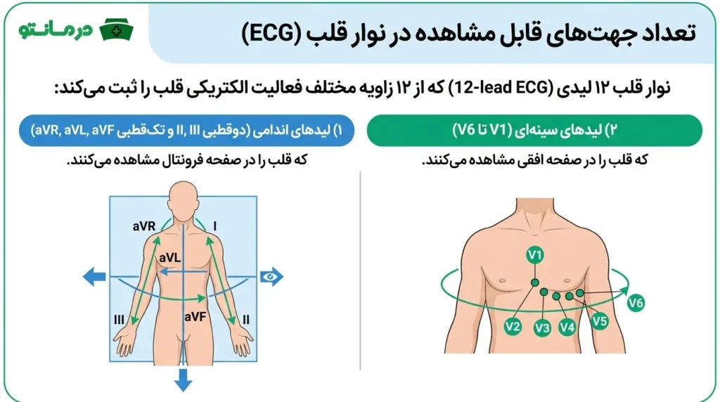 چند جهت از طریق نوار قلب قابل مشاهده است؟